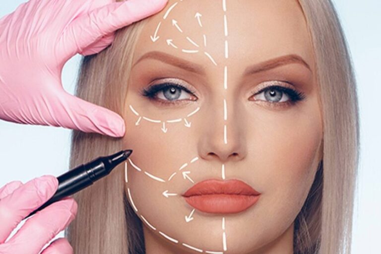 Biyolojik Lifting Aşısı