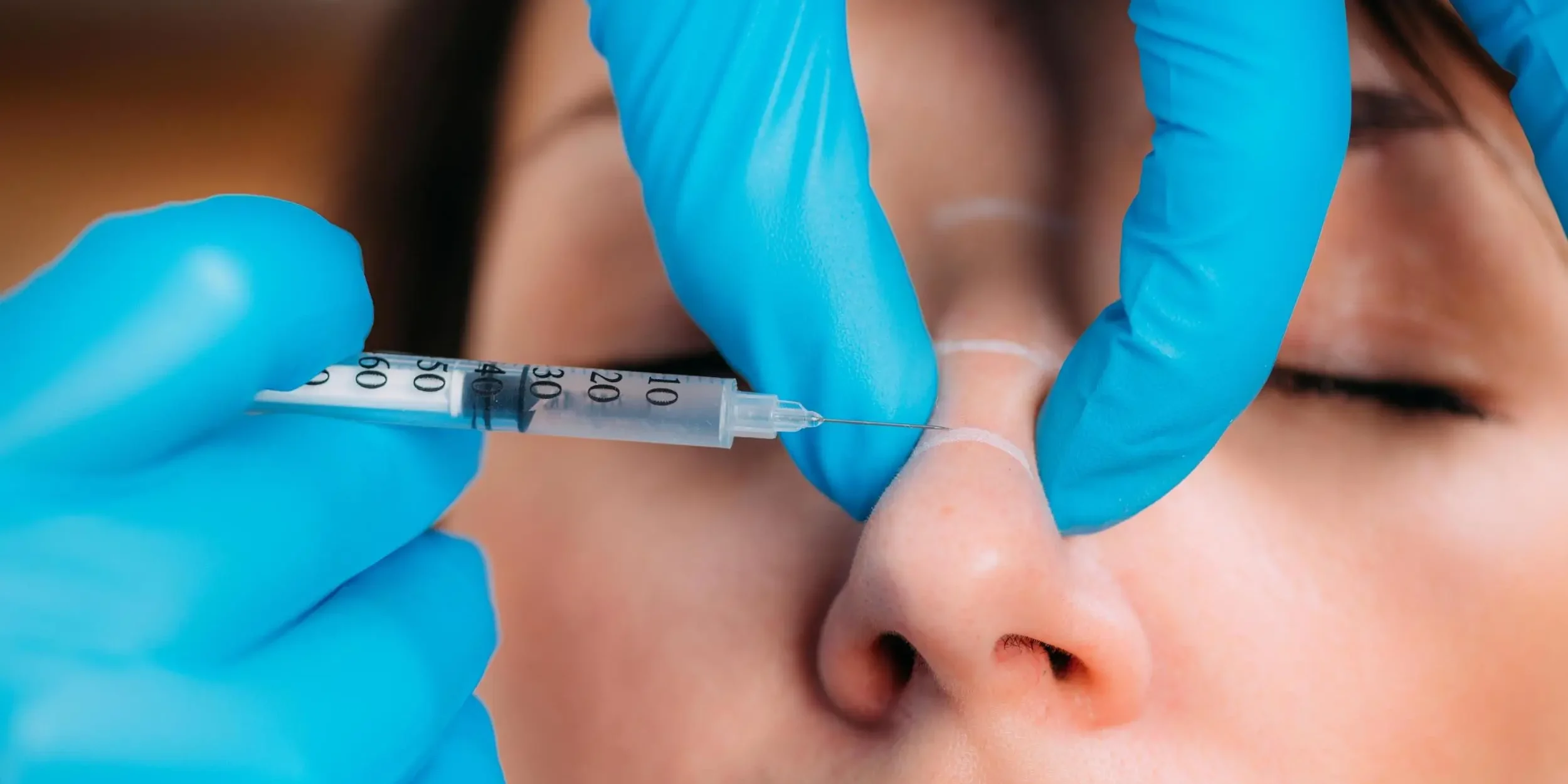 Burun Dolgusu Burun Dolgusu