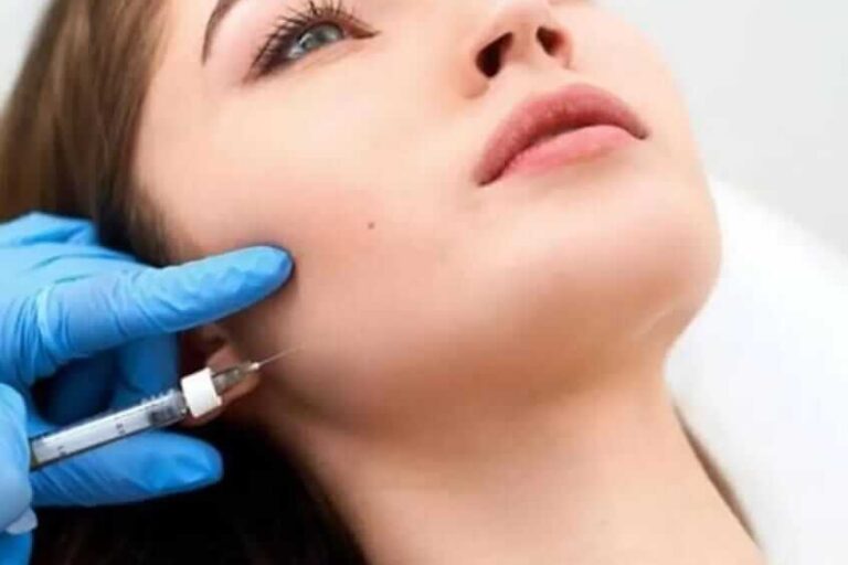 Masseter Botoks