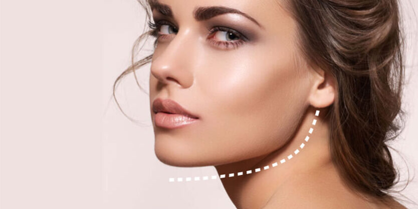 Jawline Çene Belirginleştirme