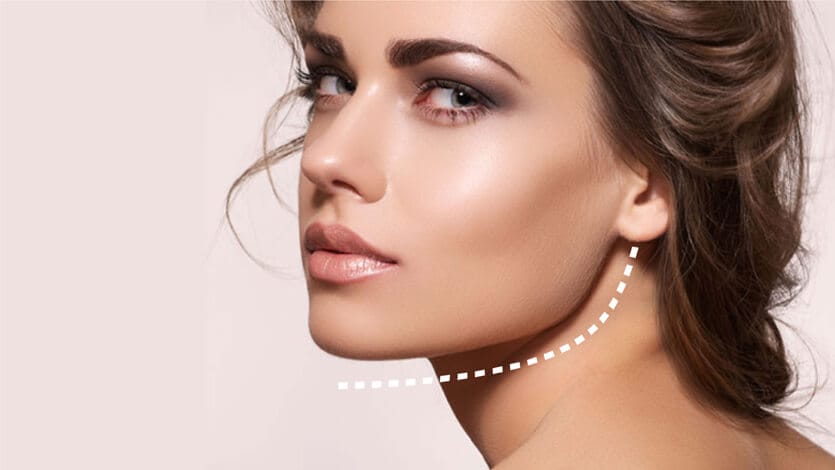 Jawline Çene Belirginleştirme