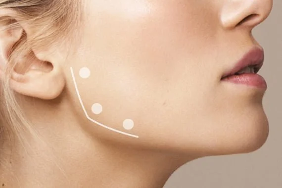 Ataşehirde Masseter Botoks Yapan Yerler Ataşehirde Masseter Botoks Yapan Yerler