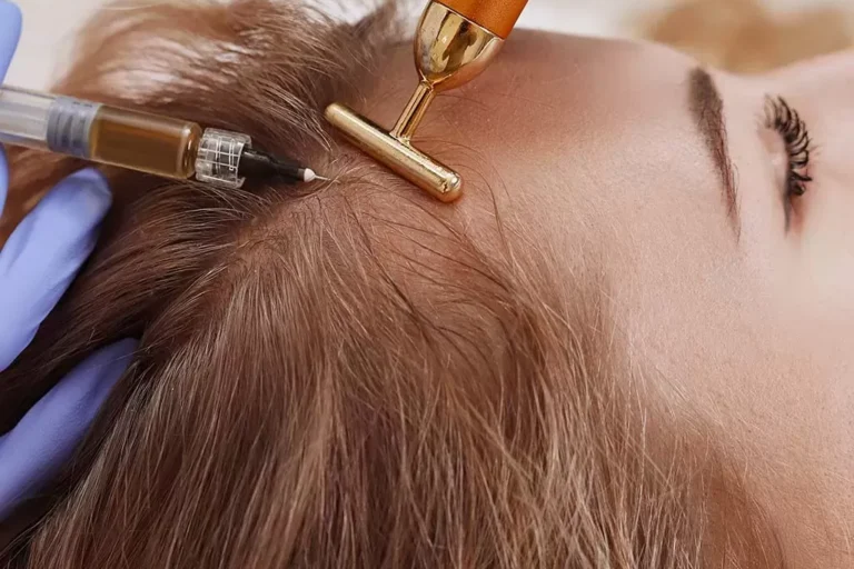 Saç Mezoterapisi
