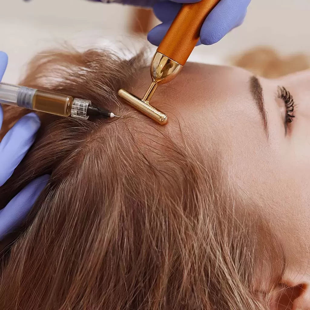 Saç Mezoterapisi