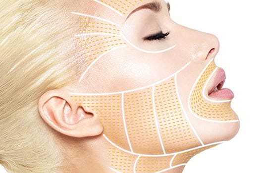 Örümcek ağı Mezoterapi