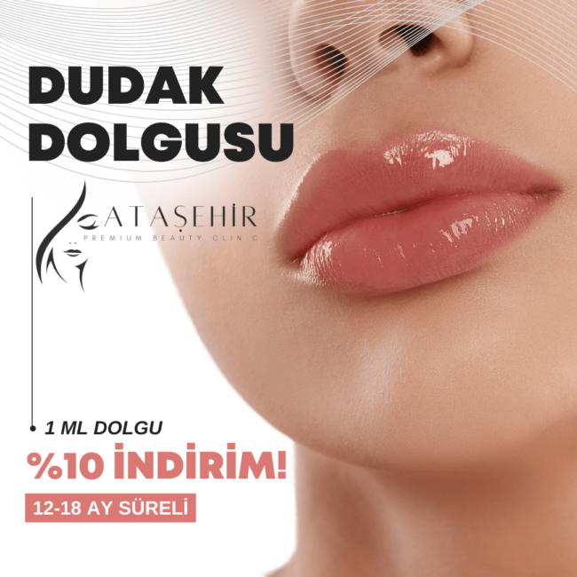 Ataşehirde Rus Dudak Dolgusu Yapan Yerler Ataşehirde Rus Dudak Dolgusu Yapan Yerler