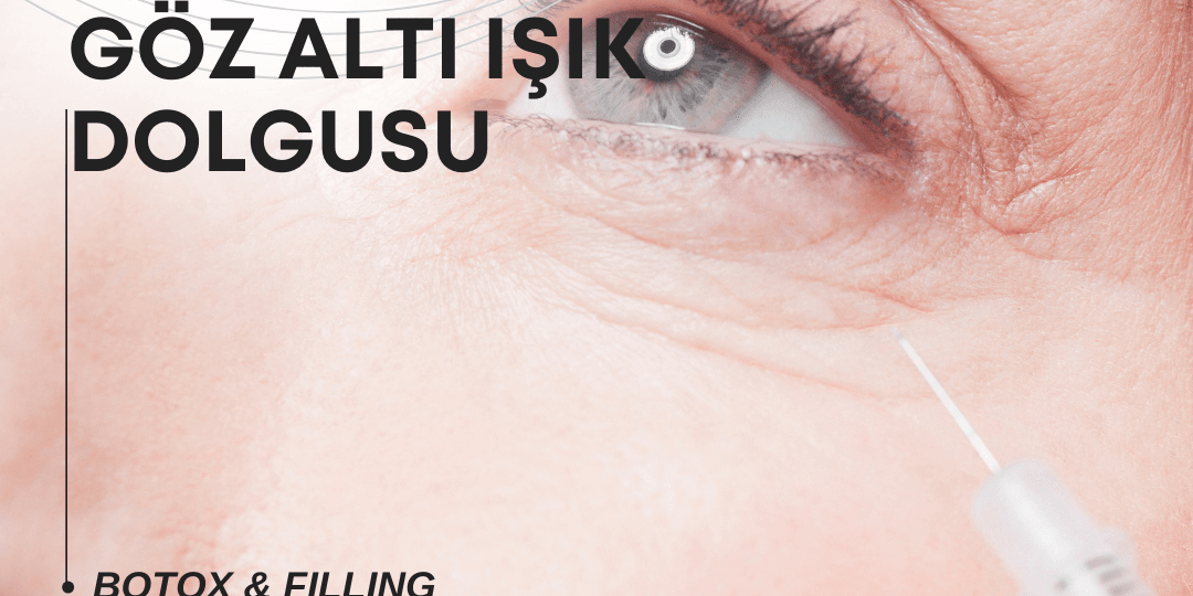 Ataşehirde Gözaltı Işık Dolgusu Yapan Yerler