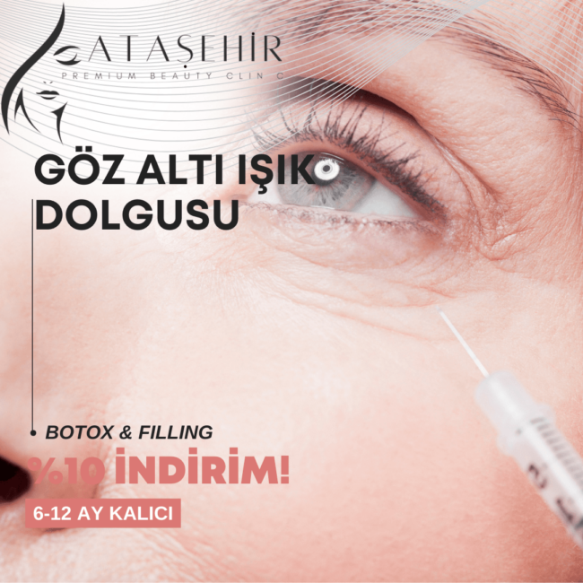 Ataşehirde Gözaltı Işık Dolgusu Yapan Yerler
