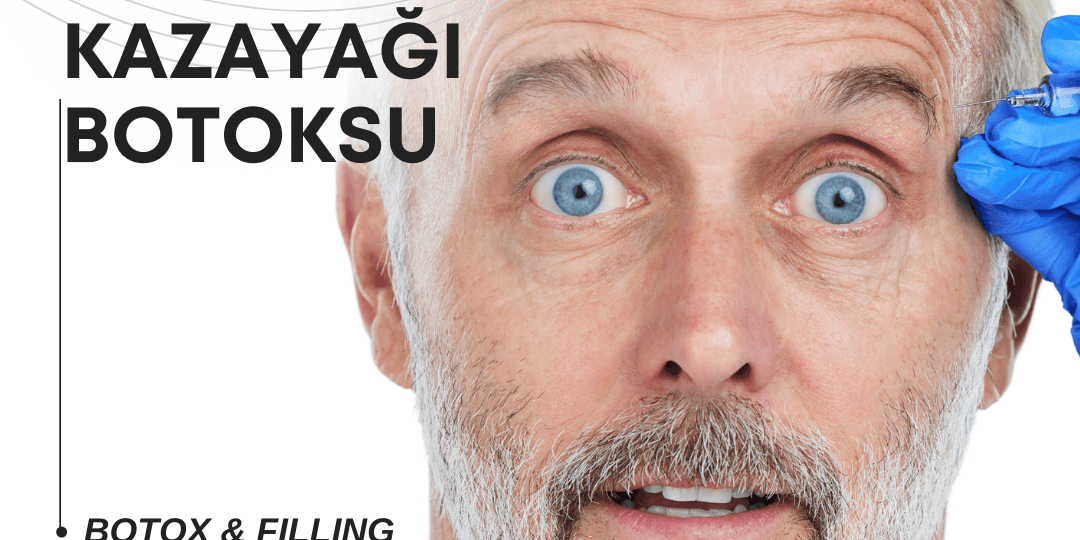 Ataşehirde 3 Bölge Botoks Yapan Yerler
